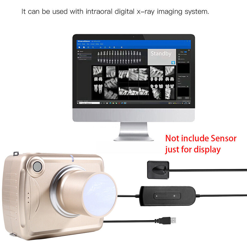 Unidad de rayos X dental portátil digital de mano de alta frecuencia